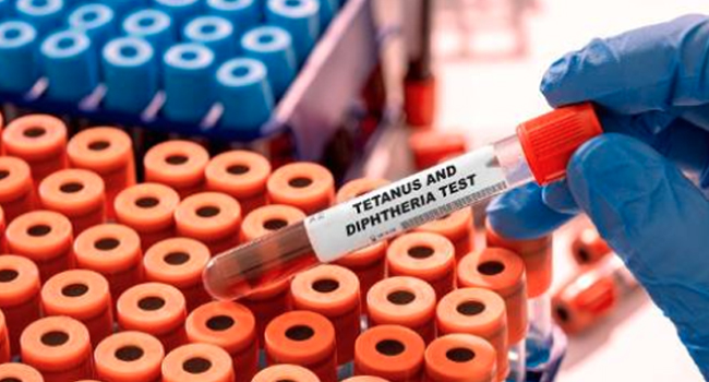 Diphtheria Kills 23 in Plateau as State Records 143 Suspected Cases